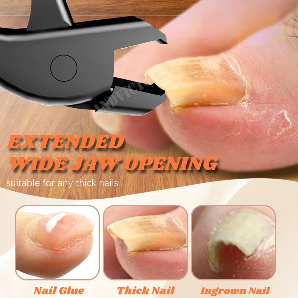 NEATEDGE – Präzisionsnagelknipser für saubere Nagelpflege