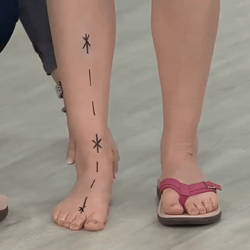 Pylomo Sandalen – Orthopädische Sommersandalen Zur Schmerzlinderung Und Haltungsverbesserung
