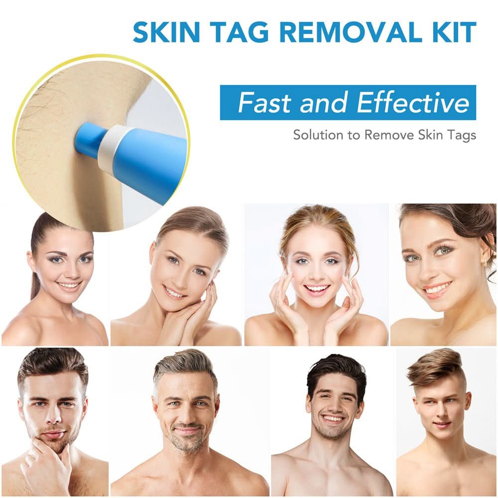 Dermaswift – Hautfleckenentferner Gegen Warzen Und Haut Anhänger
