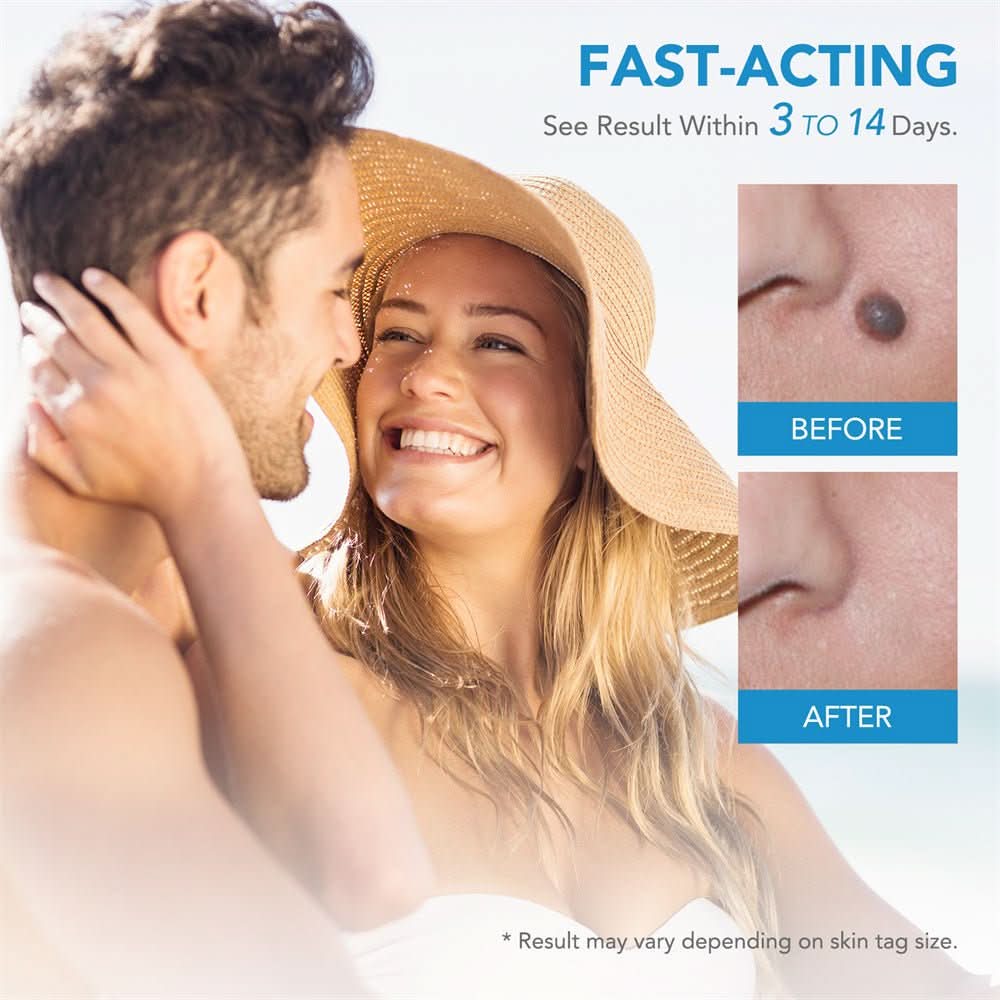 Dermaswift – Hautfleckenentferner Gegen Warzen Und Haut Anhänger
