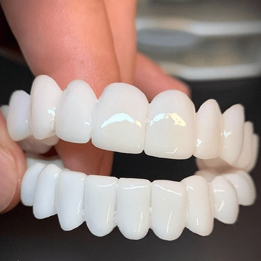 SmileFlex – Anpassbare Zahnprothese mit Zahn-Linsen