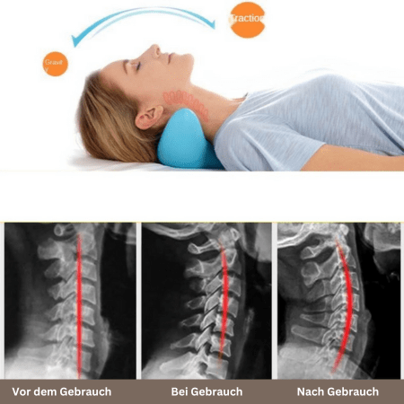 CerviRelax – Ergonomisches Nackenmassagekissen Für Entspannte Haltung